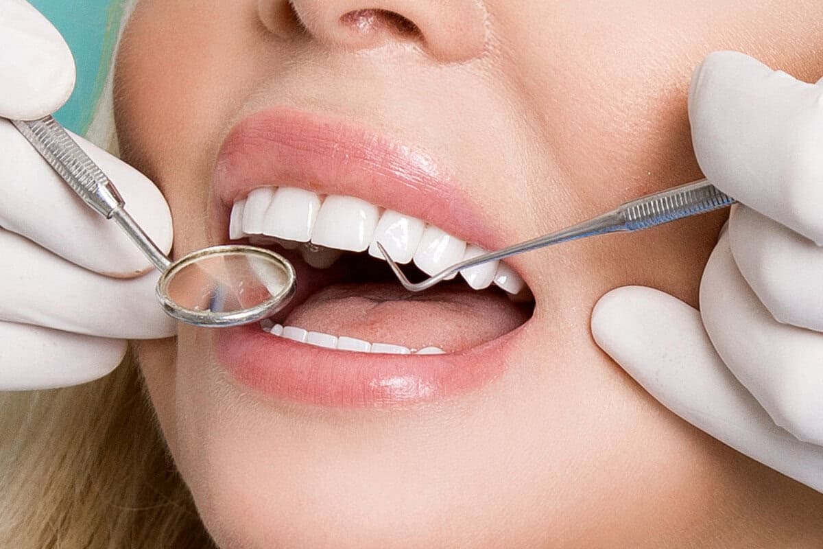 Wisdom for Your Wisdom Teeth What Every New Yorker Needs to Know