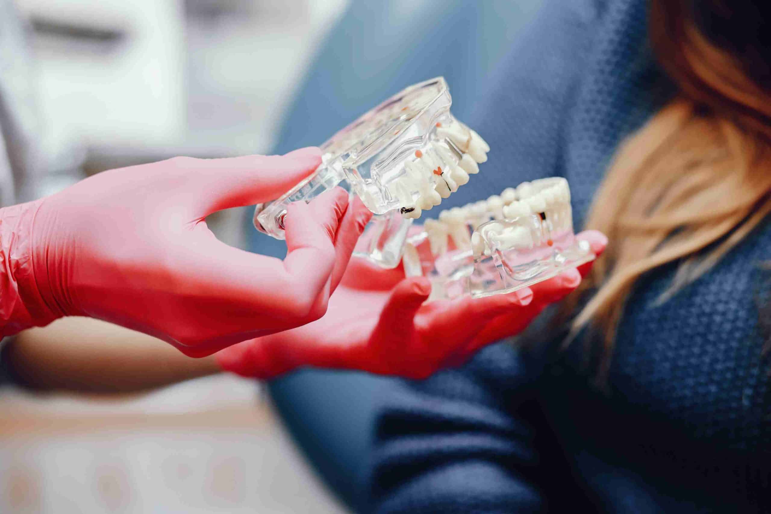 Permanent Implant Dentures NYC