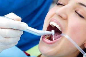 Dental Implant Procedure