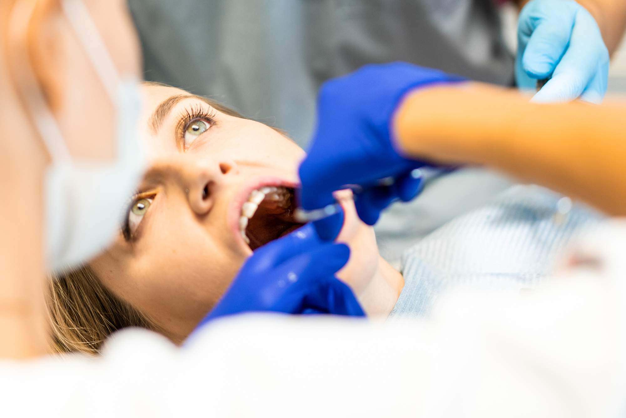 Surgical Tooth Removal NYC